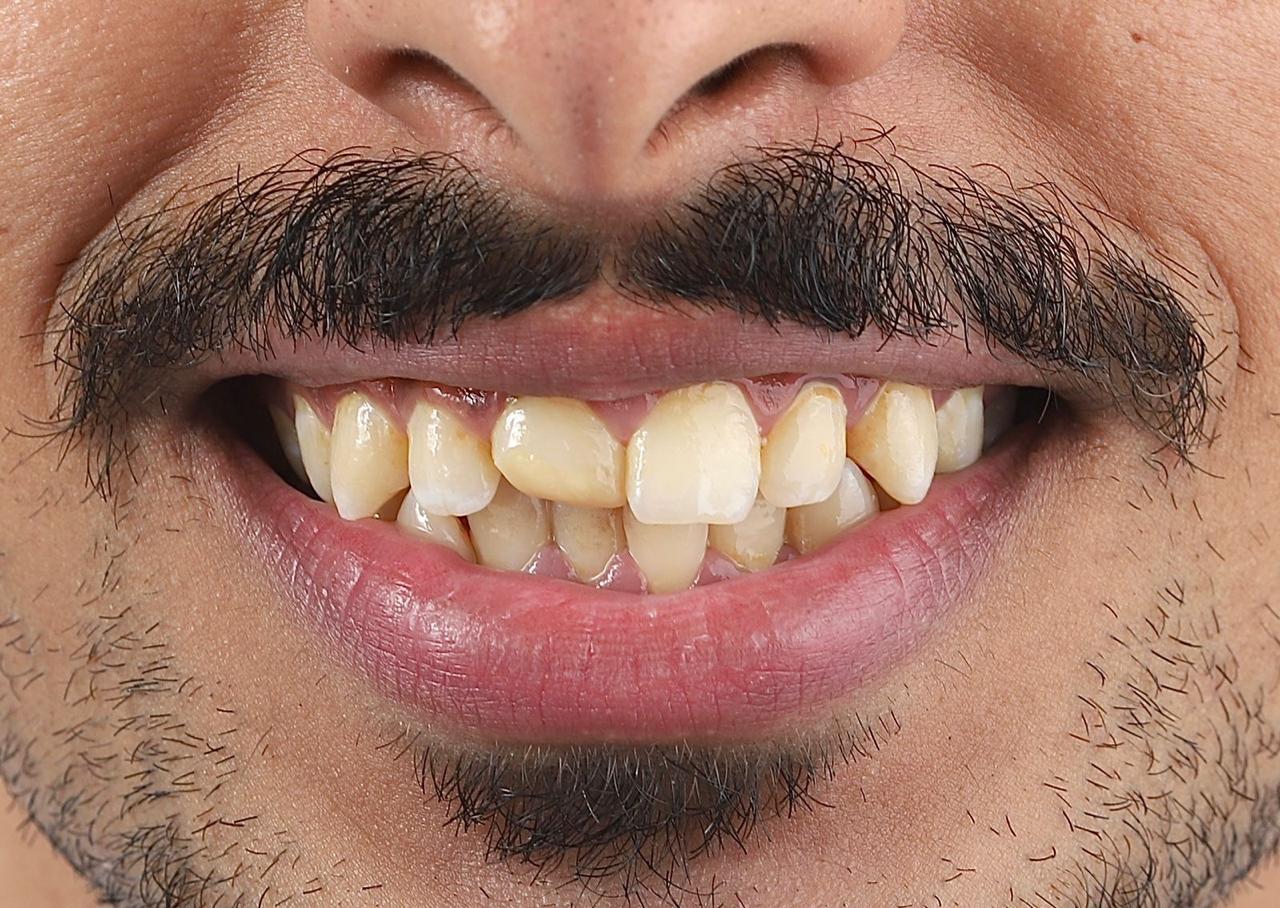 WhatsApp Image 2025-09-01 at 16.11.08_8d05972a WhatsApp Image 2025-09-01 at 16.11.08_8d05972a