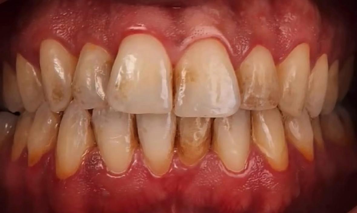 WhatsApp Image 2025-09-02 at 12.32.52 AM (1) WhatsApp Image 2025-09-02 at 12.32.52 AM (1)