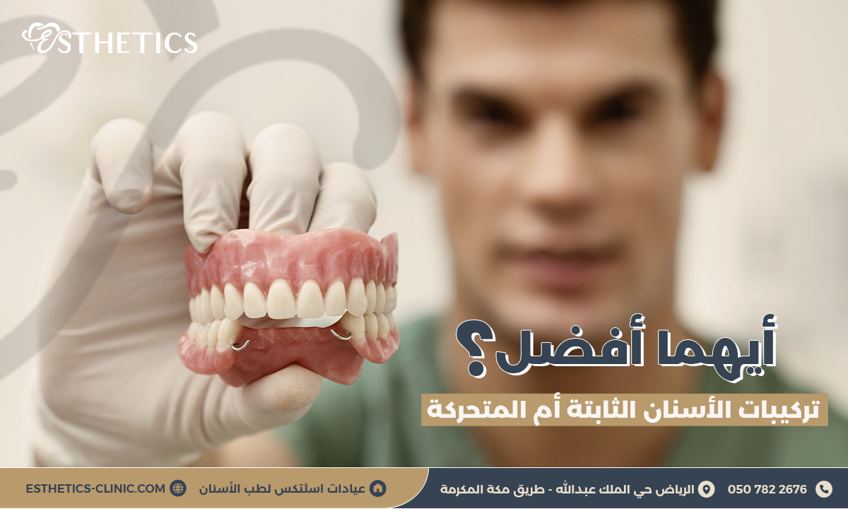 أيهما أفضل تركيبات الأسنان الثابتة أم المتحركة؟